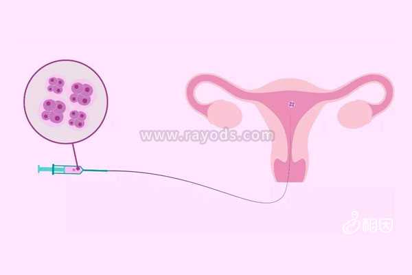 合肥试管代孕的全部费用,试管移植哪种胚胎成功率高？冻胚以及囊胚移植3种解